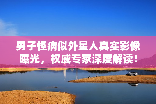 男子怪病似外星人真实影像曝光，权威专家深度解读！